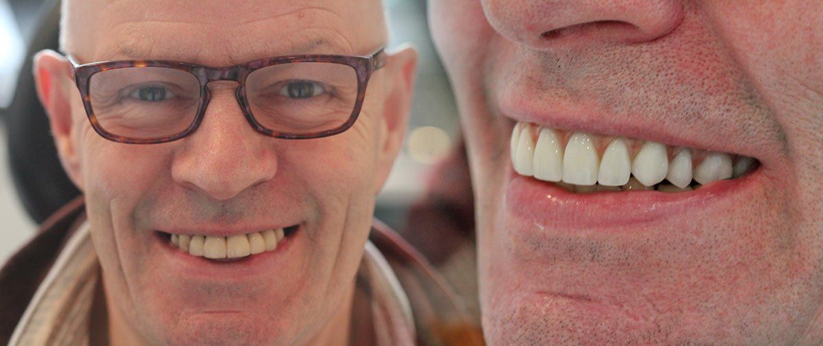 Dental Implants Birmingham