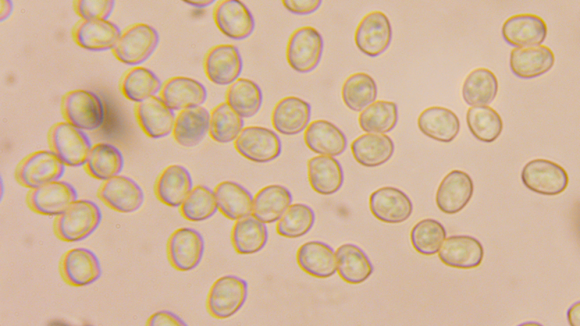 Flame Shield
Pluteus aurantiorugosus
Spores
