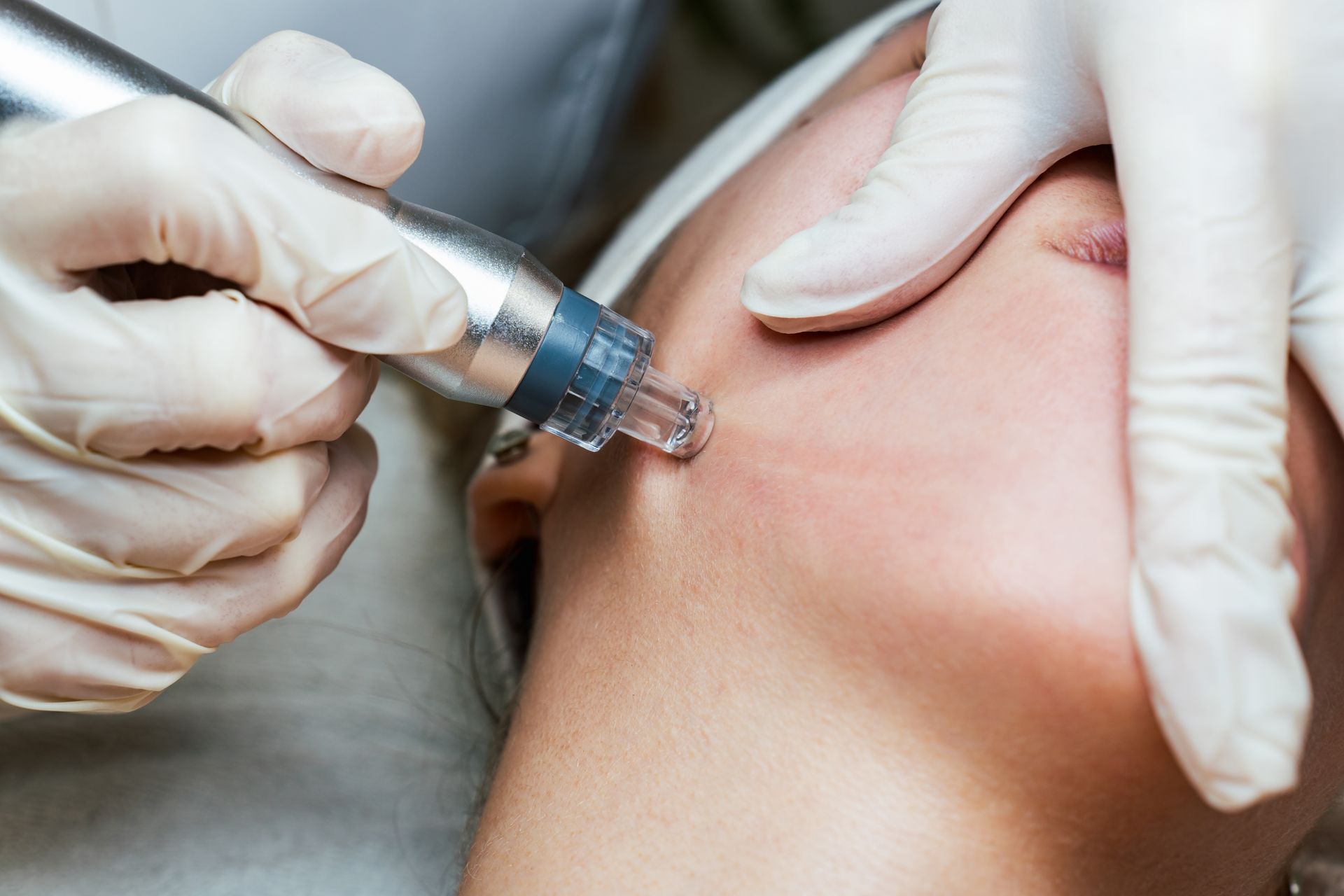A person is getting a treatment on their face with a machine.