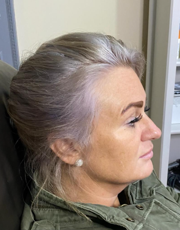 Woman with light-colored hair, wearing a green jacket, looking right. Her skin has signs of age.