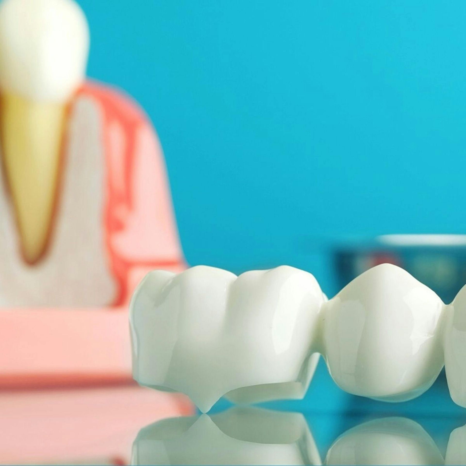 A model of a person 's teeth with a blue background