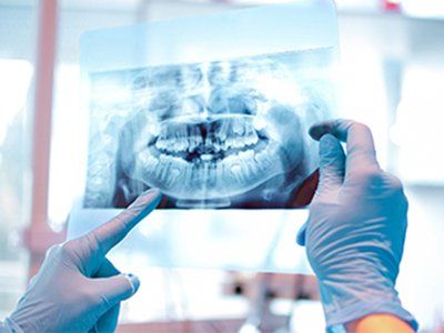 Dentist Review — Dentist Review X-Ray Result Of Patient In Newport News, VA