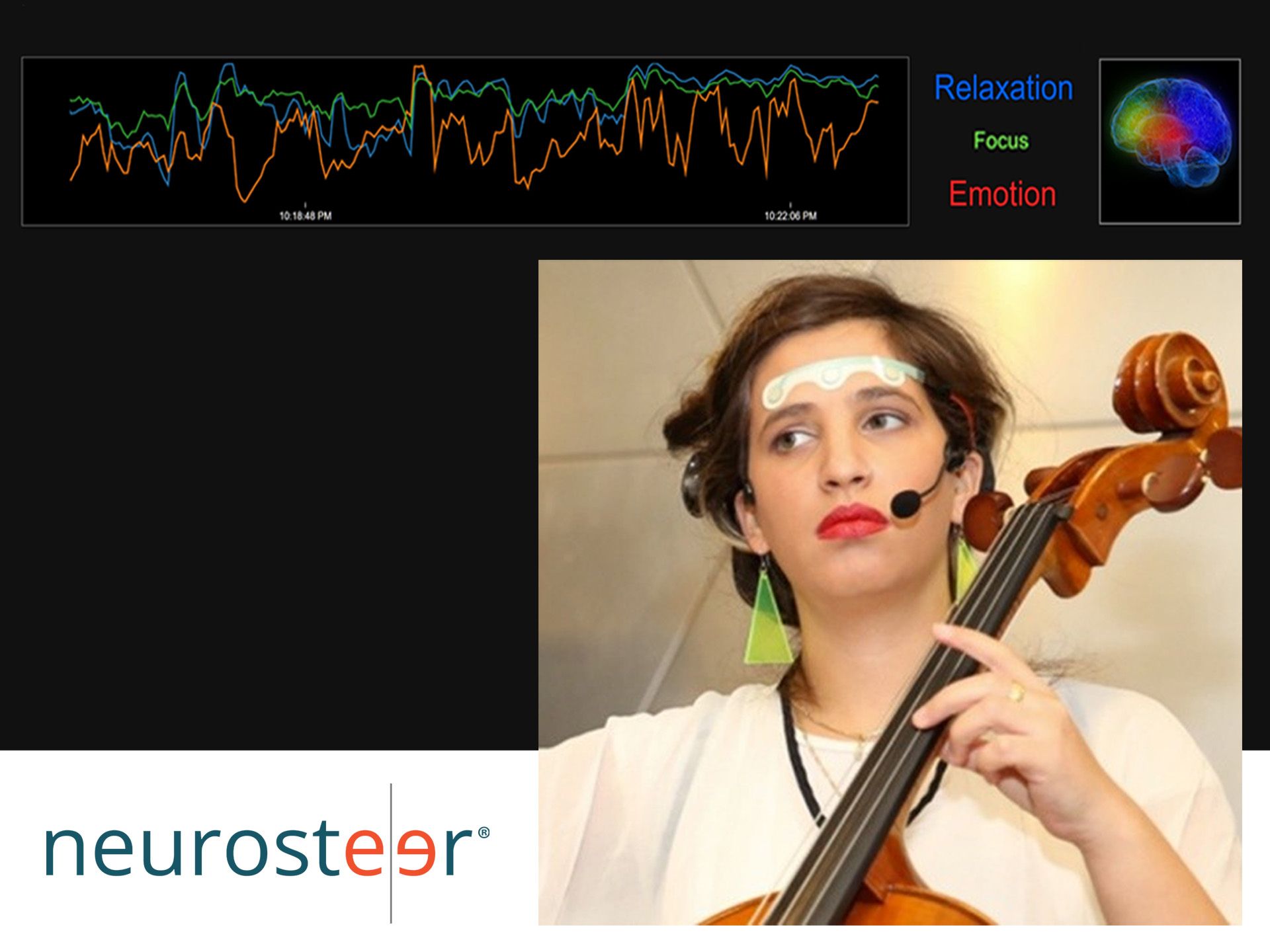 Brain Activity and Music as Seen with Neurosteer’s hdrEEG™ System