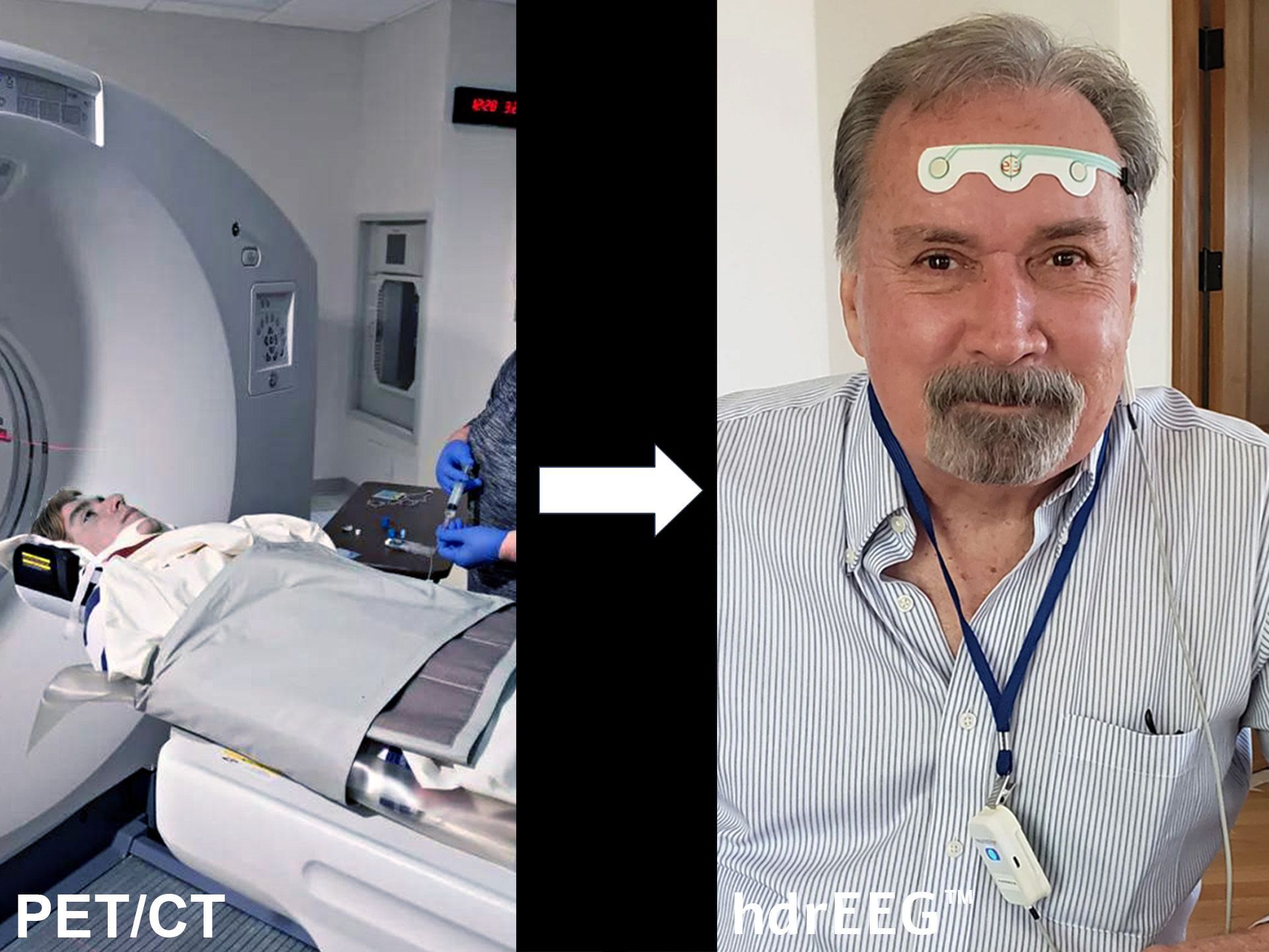 Neurosteer - Advancing the Century-Old EEG into the 21st Century
