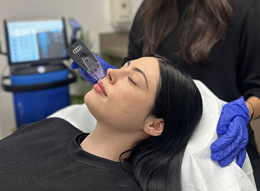 Woman receiving a facial treatment on her lips in a clinic, with a blue-gloved professional operating the device.
