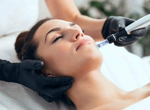 Woman receiving facial micro-needling treatment, close-up. Hands in black gloves hold tool and steady face.