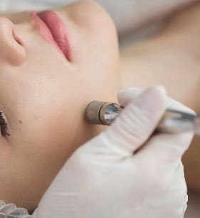 Microdermabrasion Facial Hamilton NJ