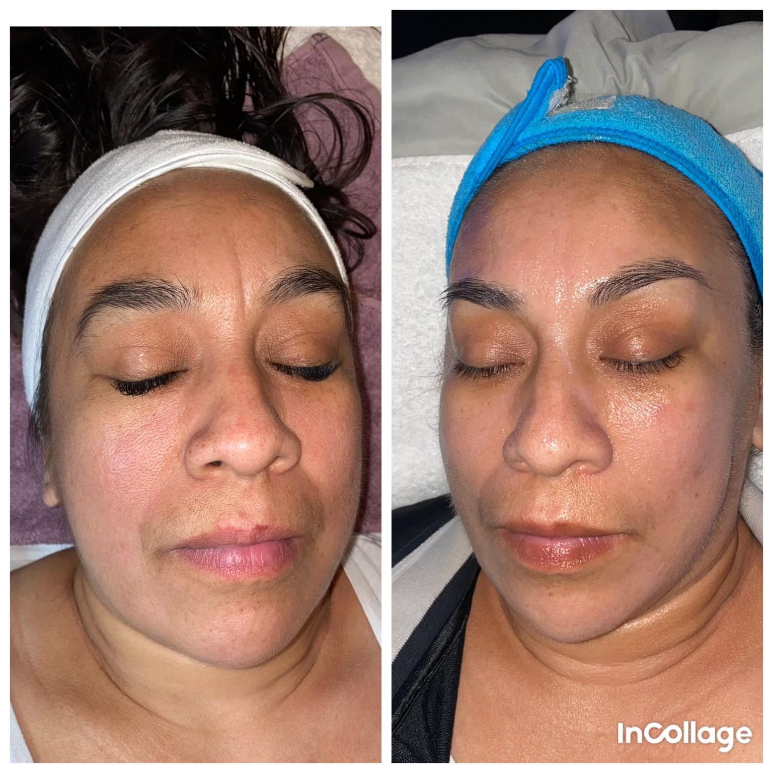 Sunset Aesthetics LLC Gallery