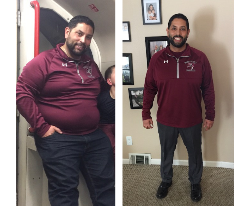 a before and after photo of a man in a maroon shirt | Simpsonville, SC | Oakview Medical
