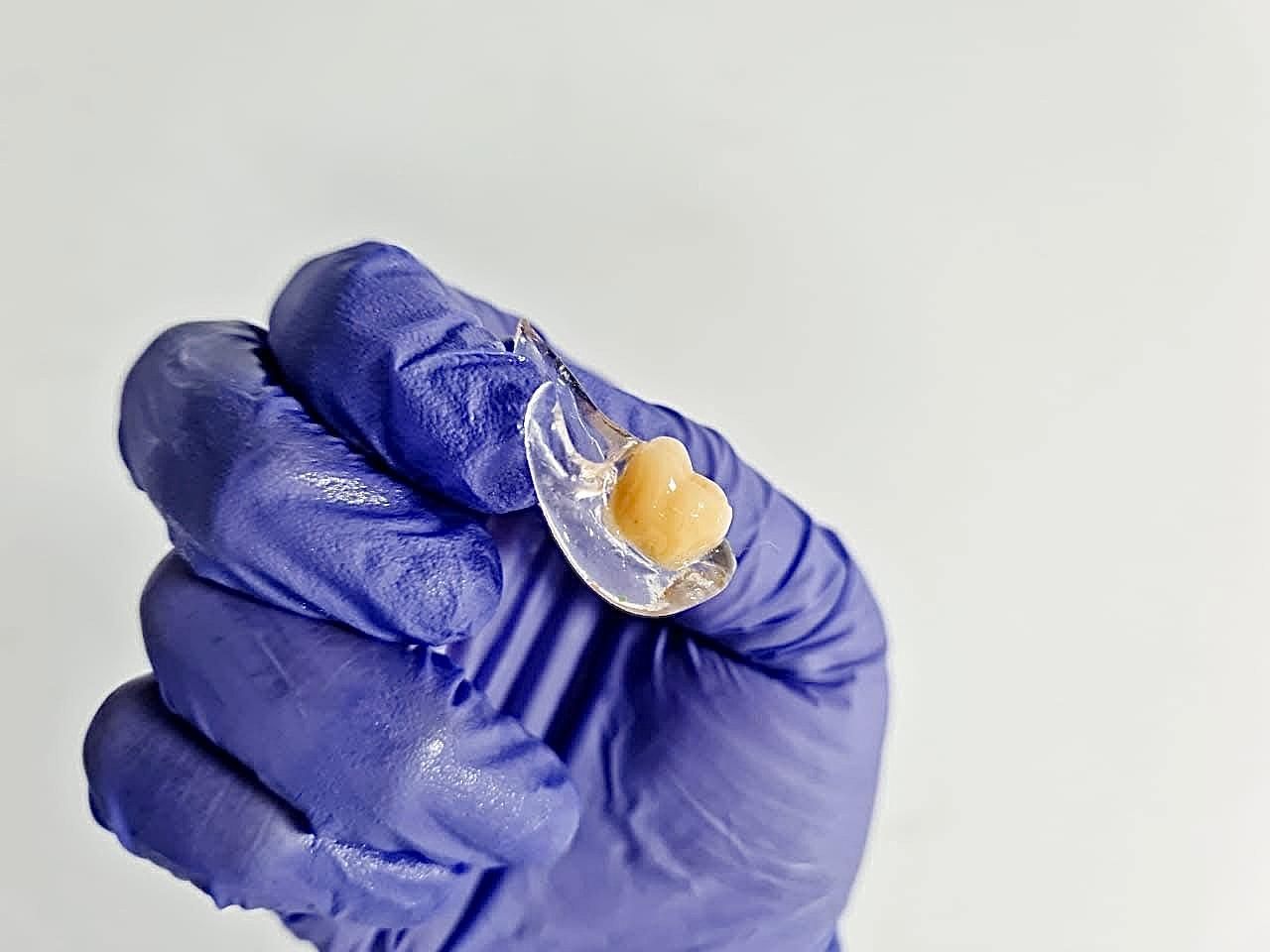 Mano enguantada sosteniendo un objeto transparente en forma de lágrima que contiene una pequeña masa de color tostado.