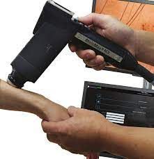 Molemax Scan 3 — Mackay, QLD — Smart Scan Clinic