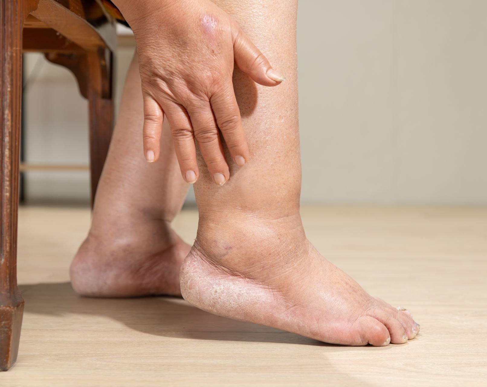 A woman is sitting on a chair holding her ankle.
