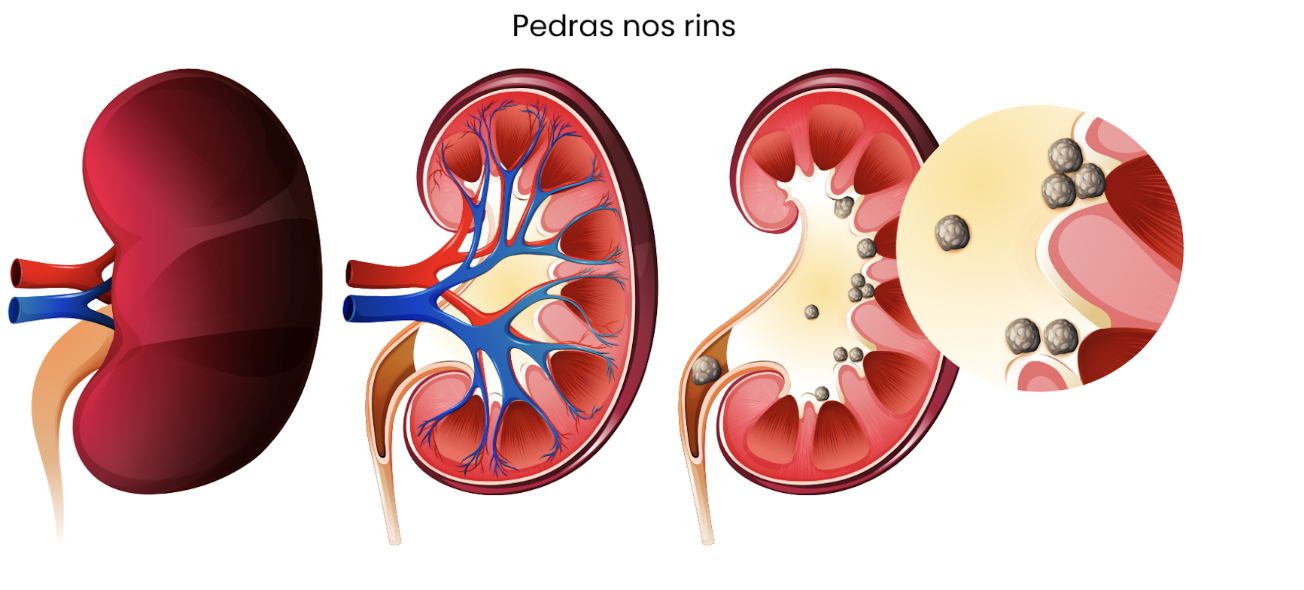 Quando realizar o exame de próstata