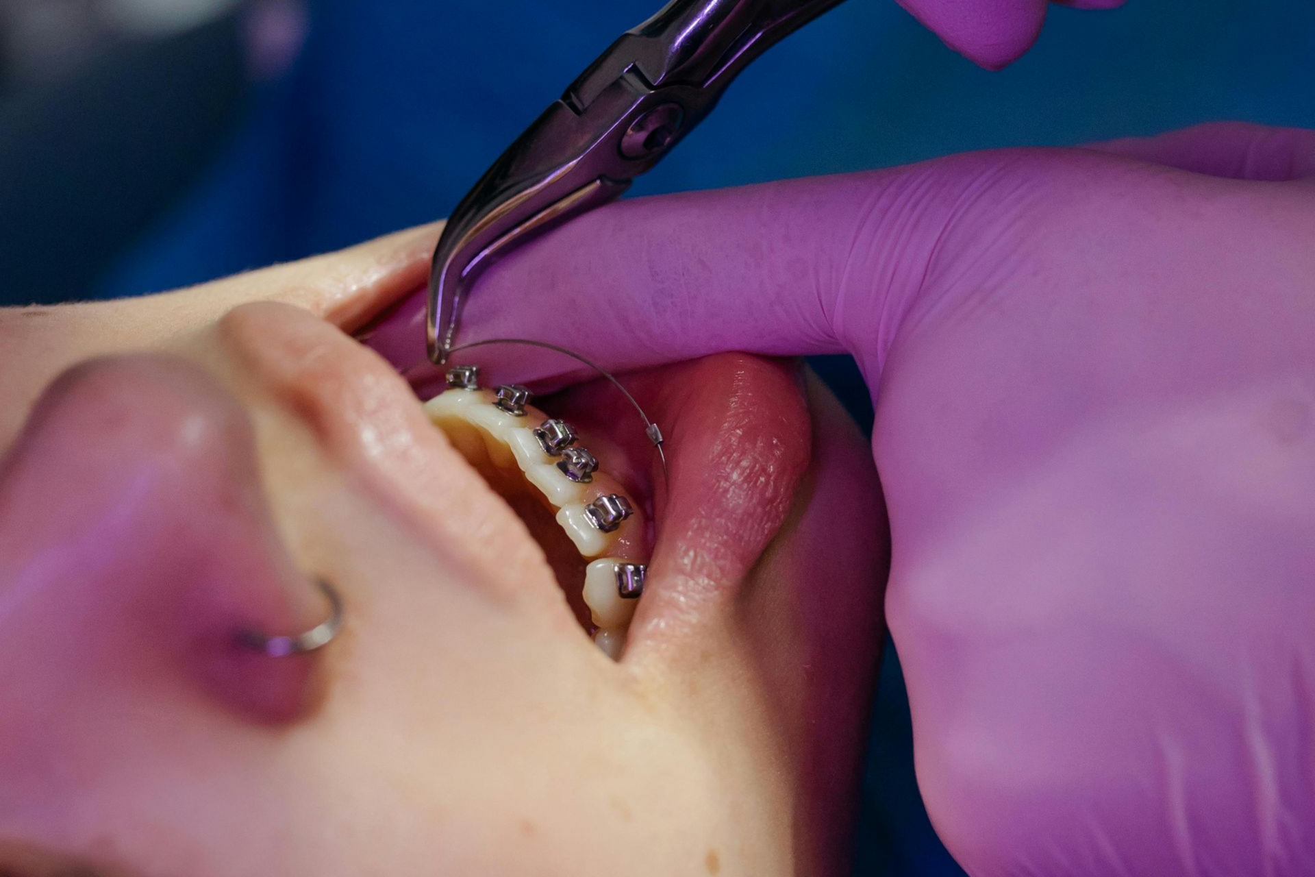 common dental myths in west haven