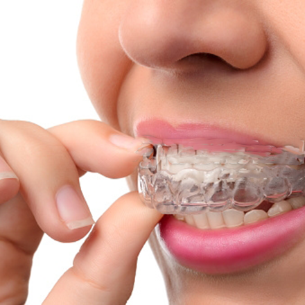 Sarah Burns Orthodontics