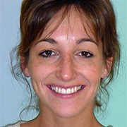 Sarah Burns Orthodontics