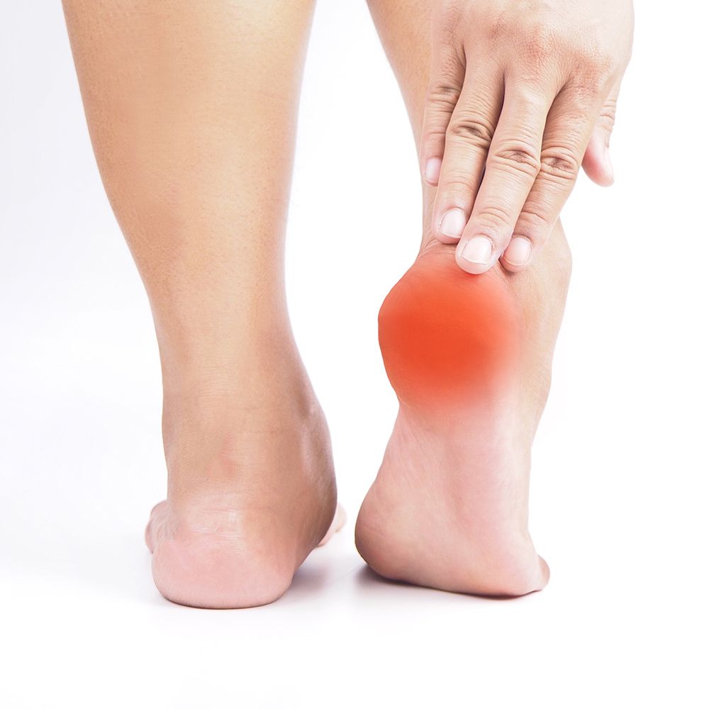 Heel Spurs