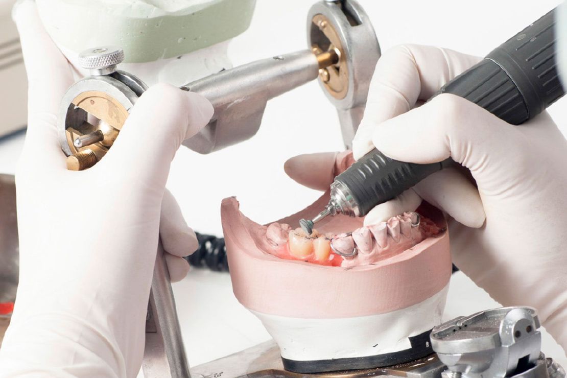 pulizia dentale professionale dimostrativa