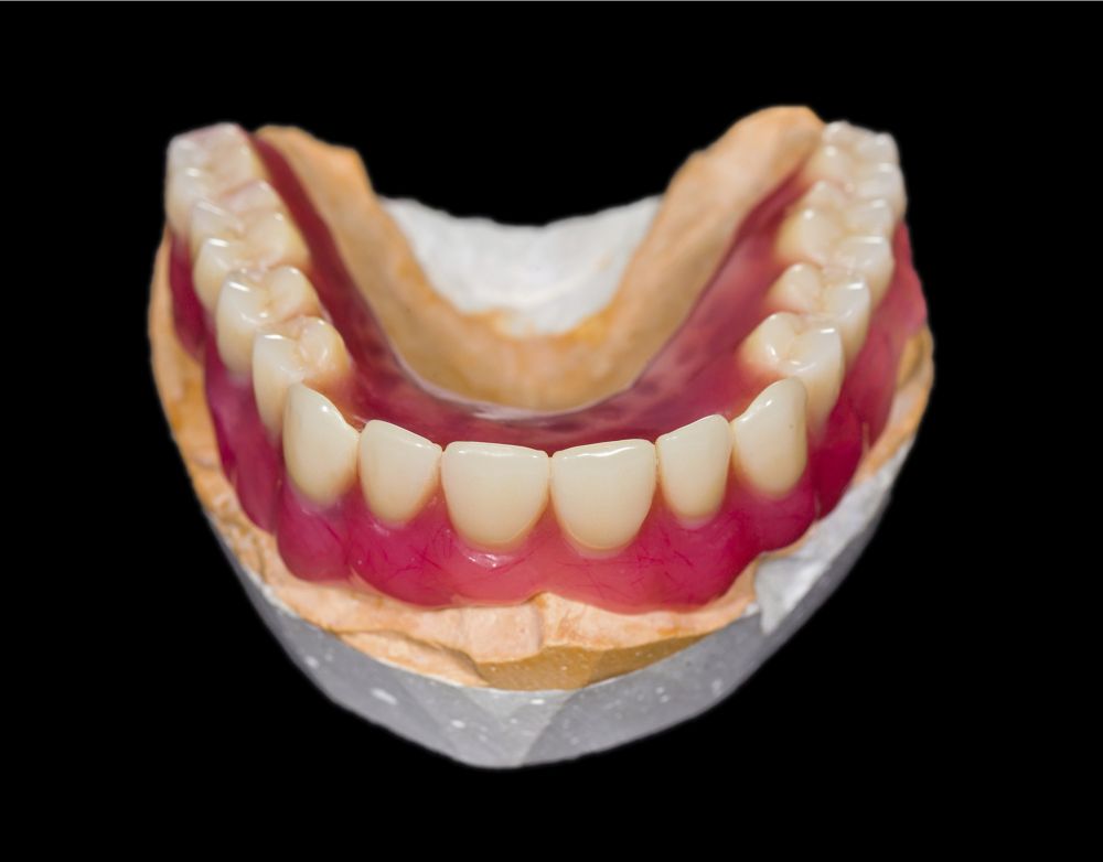riproduzione arcata dentaria inferiore