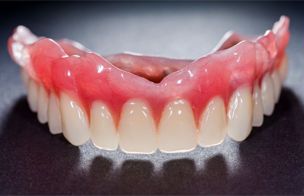 dentiera arcata superiore