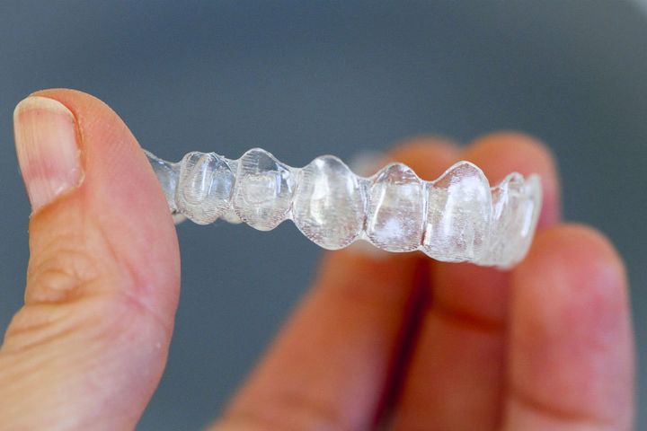 apparecchio dentale invisibile