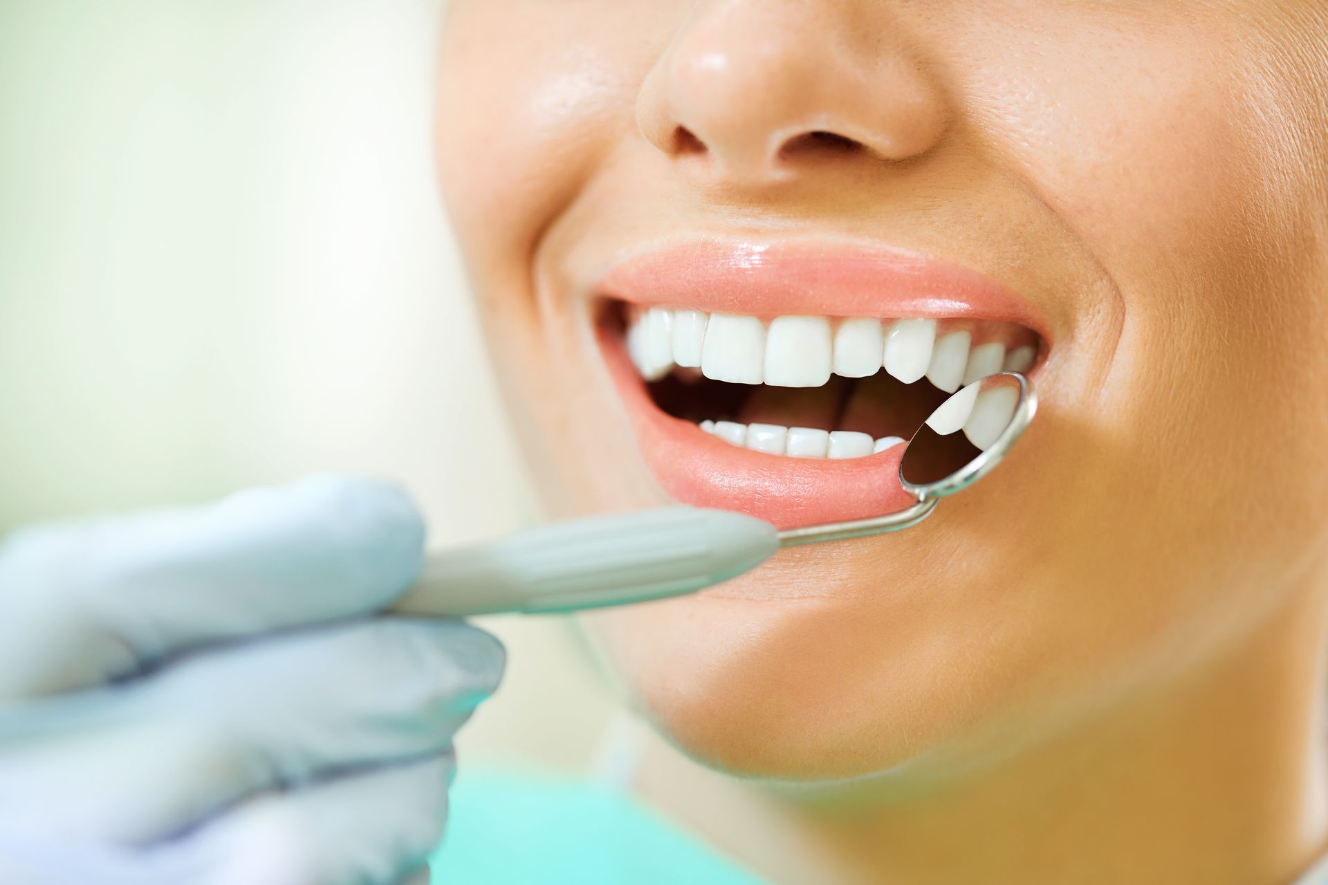 Close-up of a smiling patient's teeth examined with a dental mirror by a gloved hand