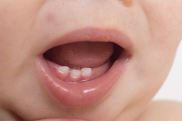 Close-up of baby's mouth with emerging lower teeth, pink gums, and slightly open lips.
