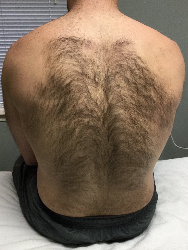 A man with a lot of hair on his back is sitting on a bed.