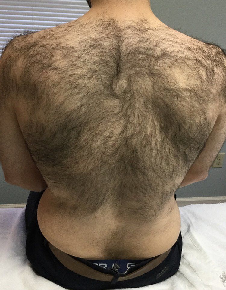 The back of a man with a lot of hair on it.