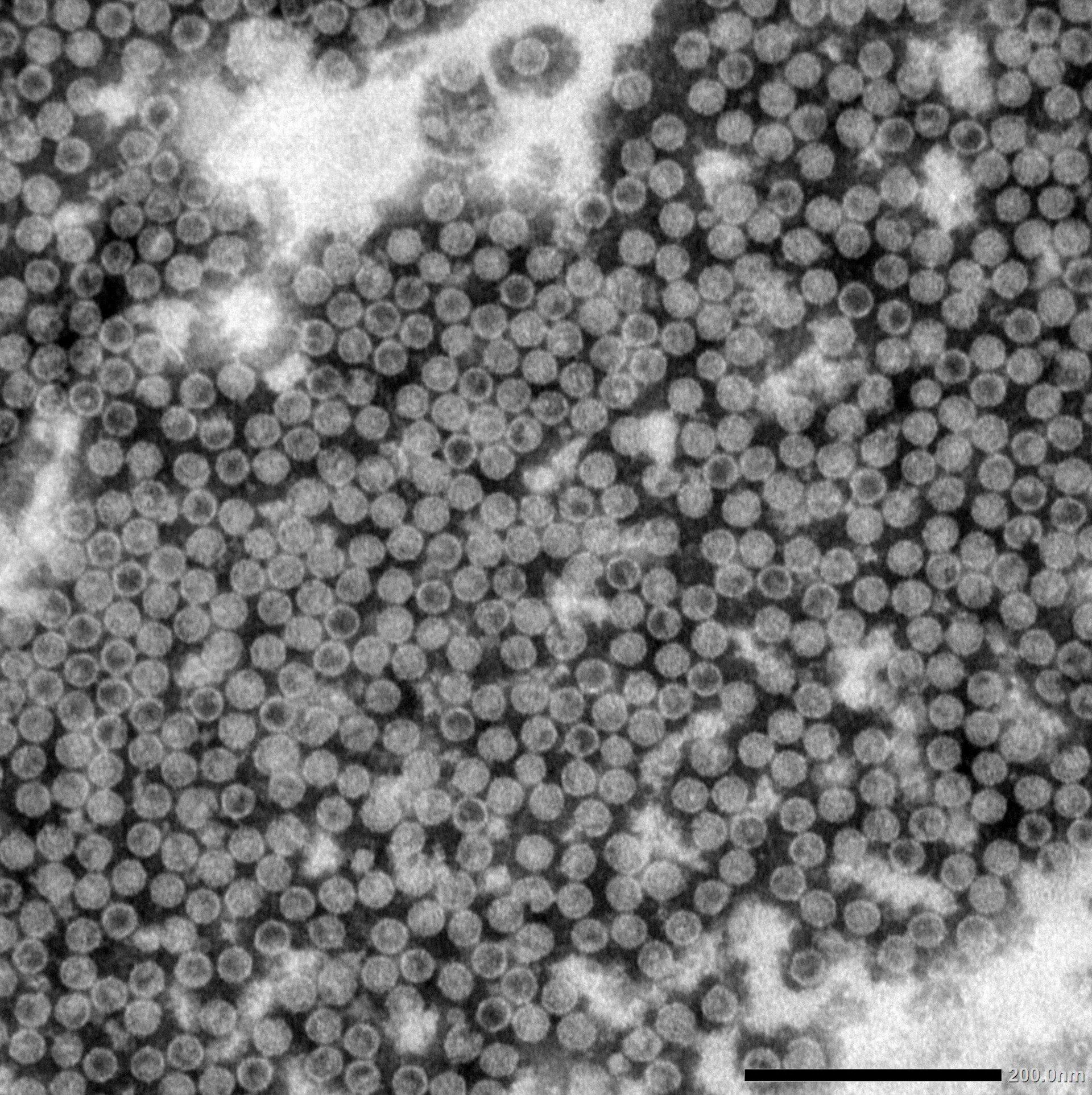 Electron micrograph of VLPs produced in ALiCE