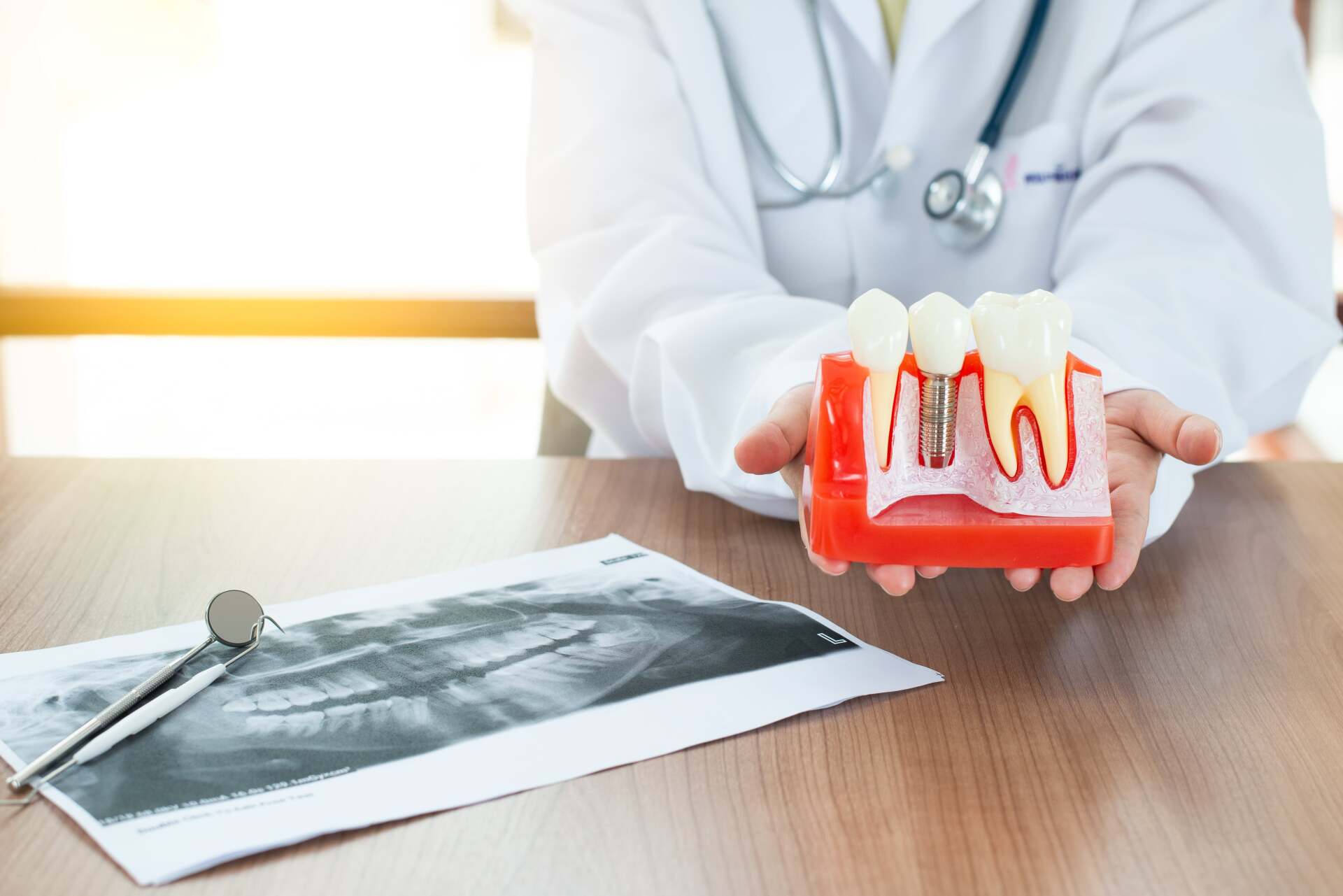 Common Dental Implant Issues and How To Treat Them | Midtown Dental Care