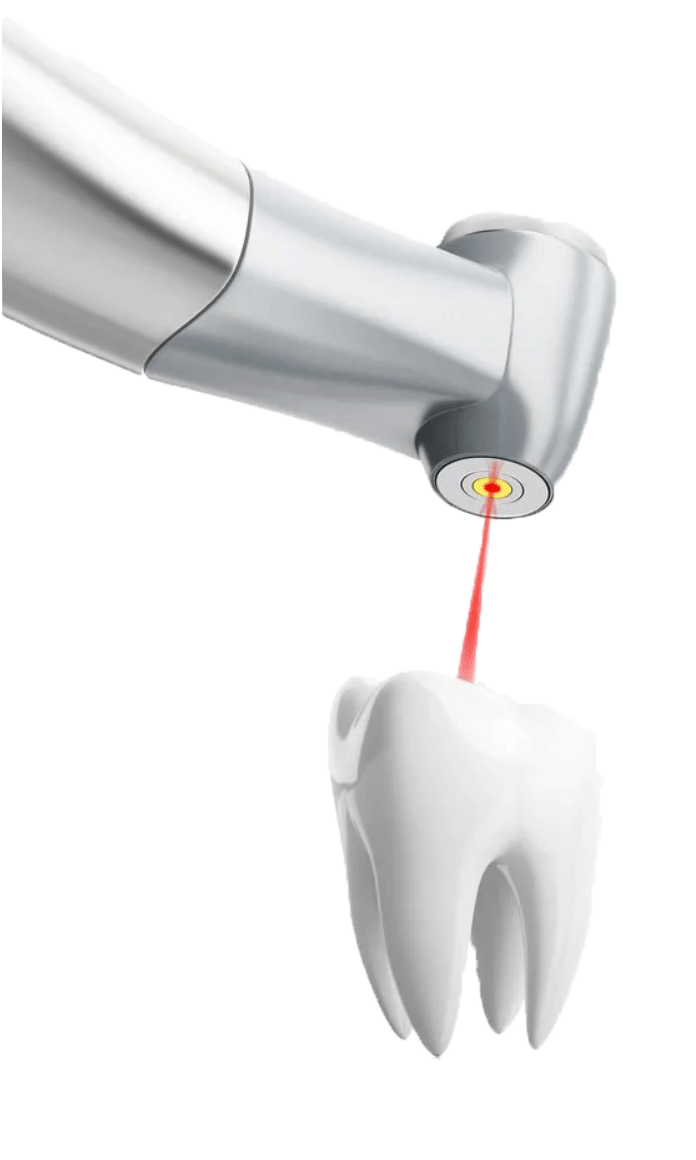 laser dentistry image