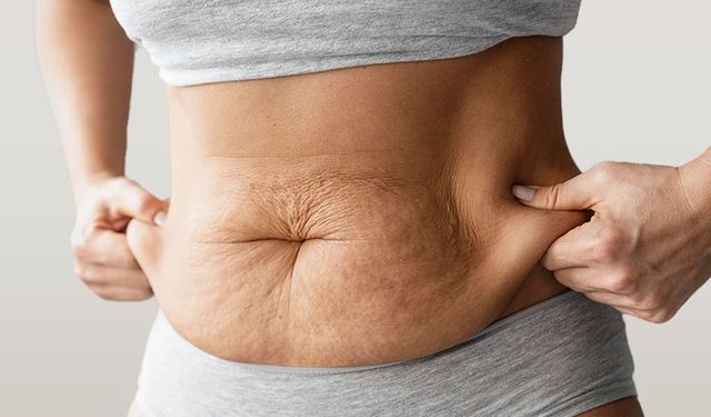 Are You a Good Candidate for Liposuction?