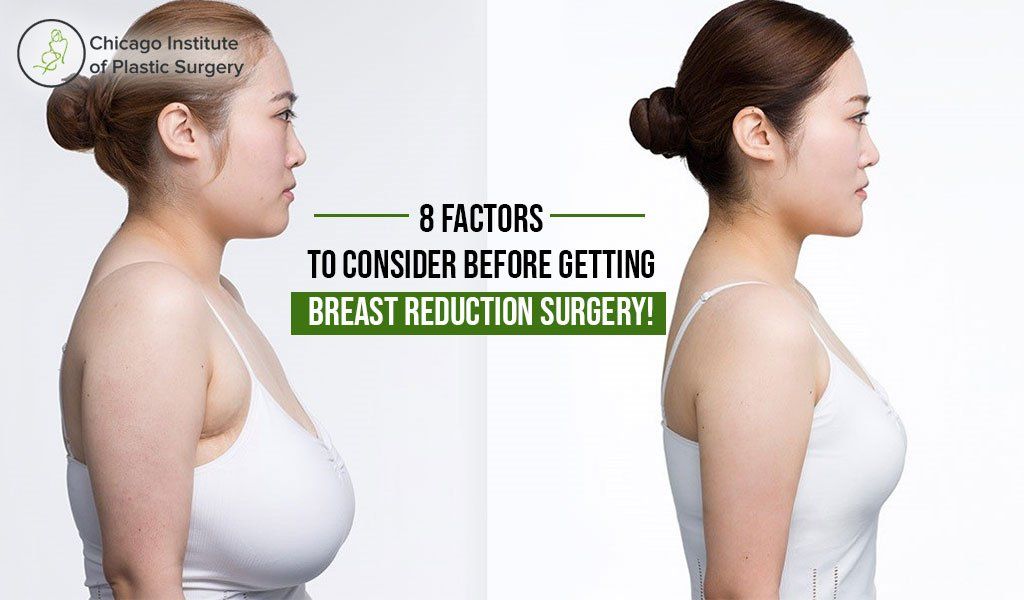 How Small Can Breast Reduction Make My Cup Size?