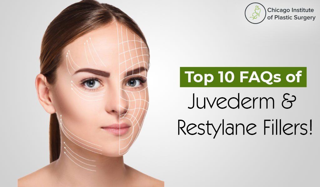 Top 10 FAQs of Juvederm and Restylane Fillers