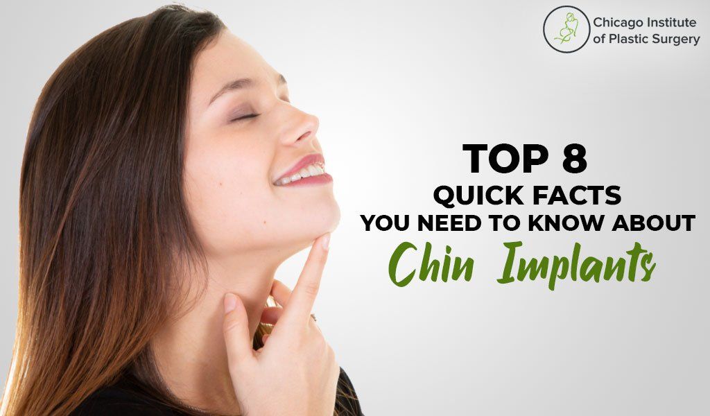 Top 8 Quick Facts You Need to Know About Chin Implants 