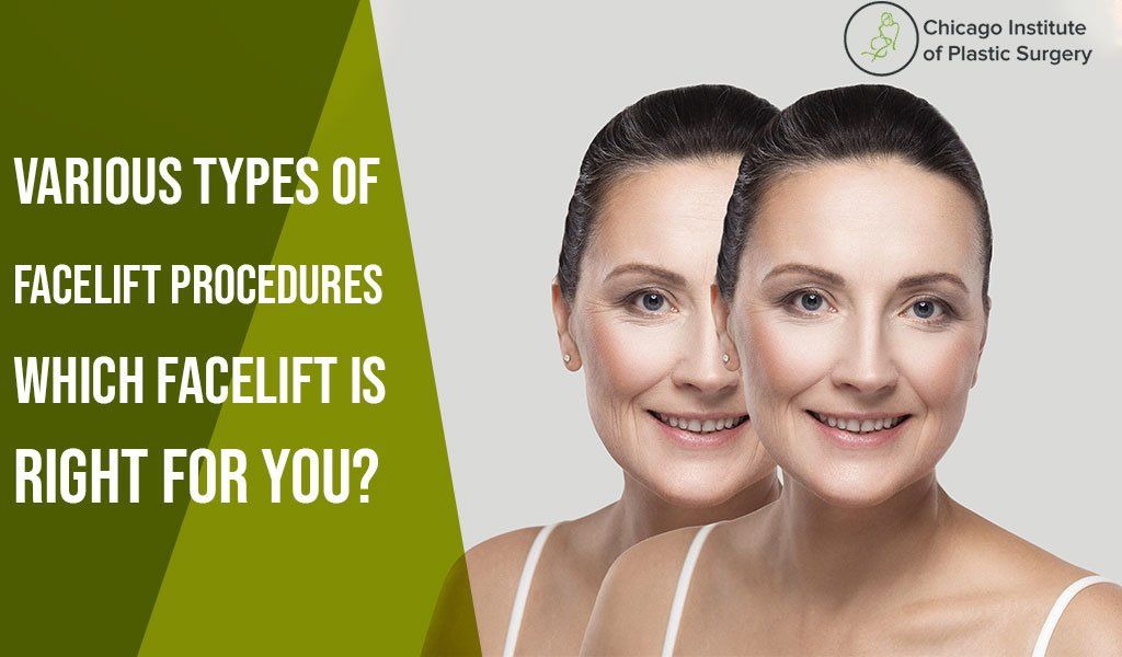 Various Types of Facelift Procedures-Which Facelift is Right for You