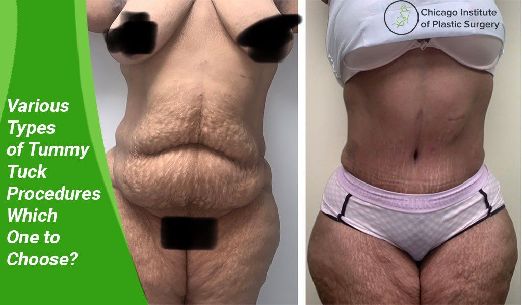 Is it legal to buy someone's sweaty underwear? - Chicago Reader