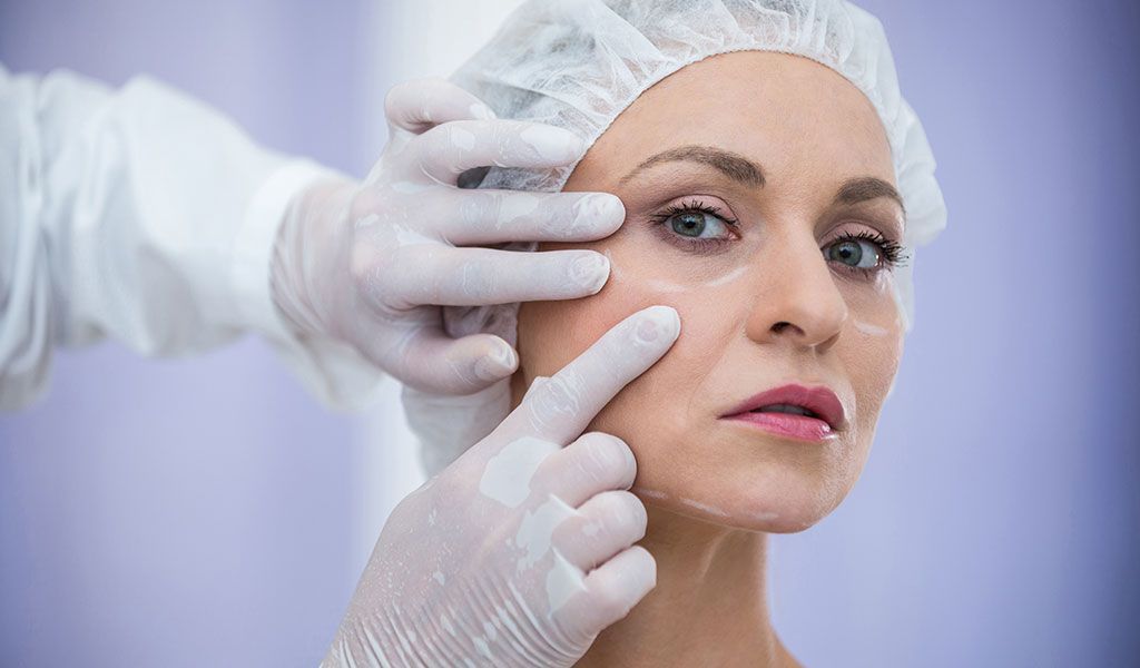 What to Expect at your Consultation with Plastic Surgery in Schaumburg