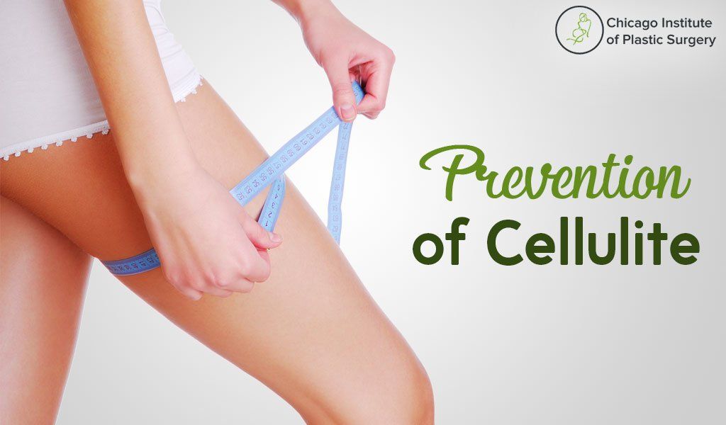 Prevention of Cellulite and Reduction Treatment in Chicago Institute of Plastic Surgery Clinic