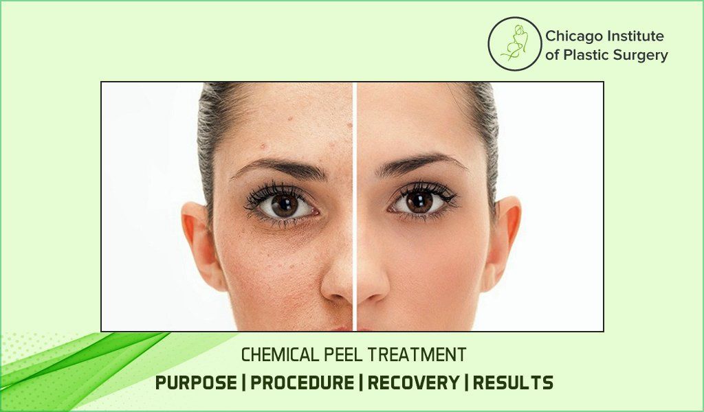 10 Things to Expect After Your First Chemical Peel - U.S. Dermatology  Partners