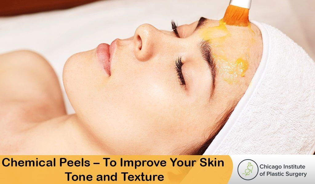 Chemical Peels Treatment – To Improve Your Skin Tone and Texture - Plastic Surgery Clinic