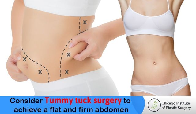 Tummy Tuck, Abdominoplasty 🙌 Do you want your tummy tuck to result in a  flatter, firmer abdominal contour that is more proportionate…