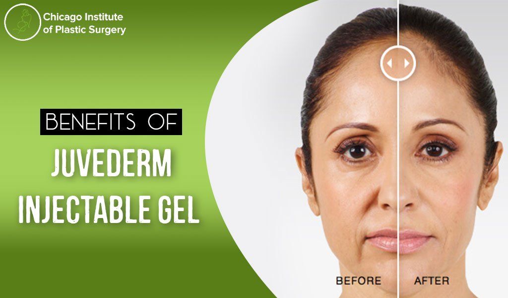 Effectiveness and benefits of Juvederm injectable Gel for aesthetic appearance