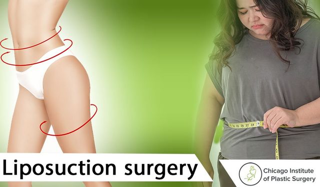 Enhance your body shape and self-esteem by considering Liposuction surgery
