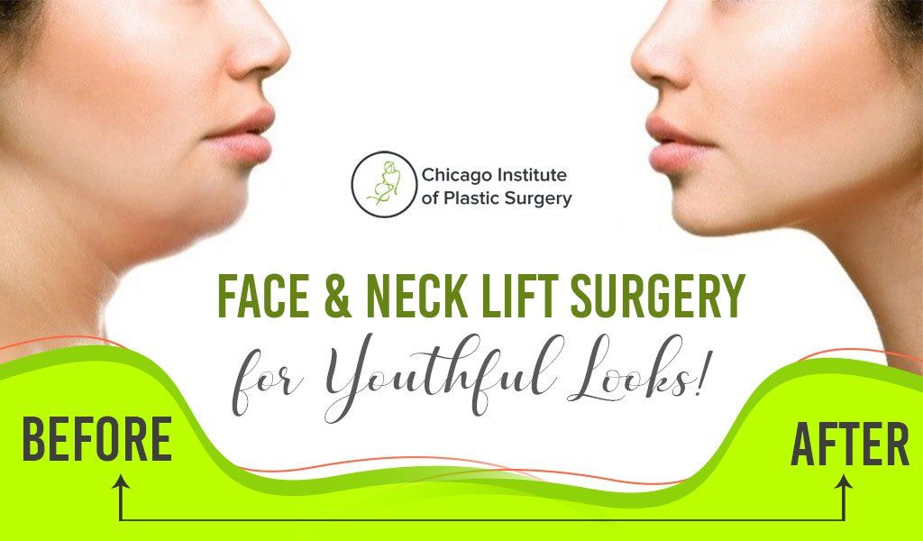 Face & Neck Lift Surgery for Youthful Looks!