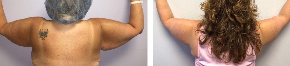 A before and after photo of a woman with long hair.