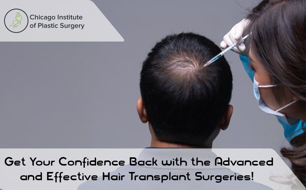 Get Your Confidence Back with the Advanced and Effective Hair Transplant  Surgeries!
