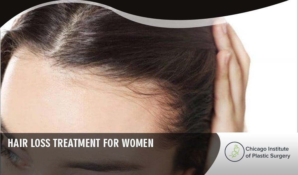 Hair Loss Treatment for Women in Chicago