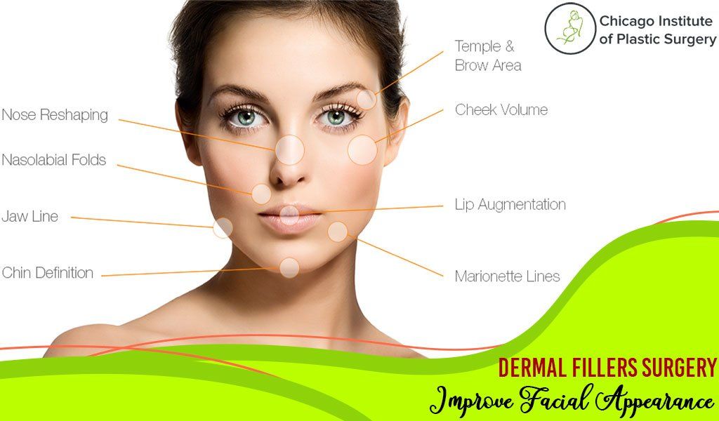 How “Dermal Fillers Treatment” Improve Your Appearance?